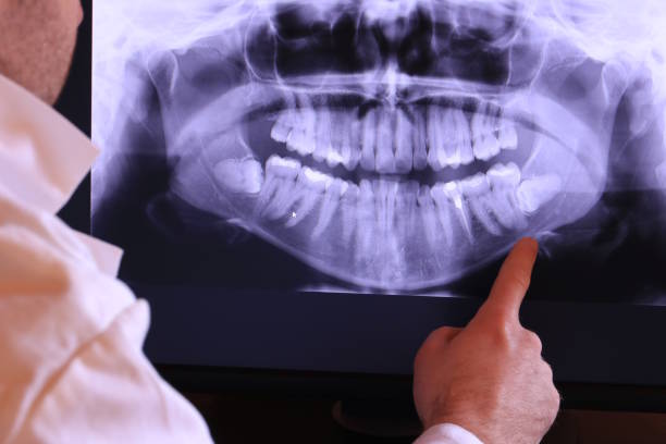 Best Broken Tooth Emergency  in Bell Nyon, CA